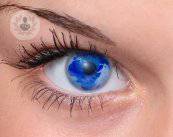 il-cross-linking-corneale-l-alternativa-al-trapianto-di-cornea immagine dell'articolo