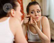 l-acne-non-e-causata-da-quello-che-mangi immagine dell'articolo