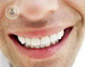 A cosa servono le microviti ortodontiche?