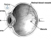 Il glaucoma: la principale causa della cecità irreversibile