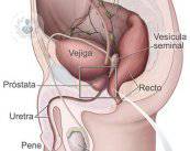 I sintomi, la diagnosi e il trattamento del cancro alla prostata