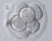 Cosa succede dopo il trasferimento di embrioni?
