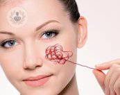 ho-scoperto-di-avere-la-rosacea-come-si-cura immagine dell'articolo