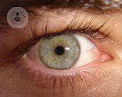 Il laser per curare le lesioni oculari