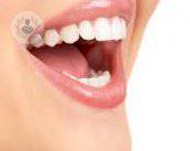 come-ottenere-buoni-risultati-dagli-impianti-dentali immagine dell'articolo