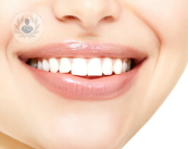 Impianti dentali: sono davvero così utili?