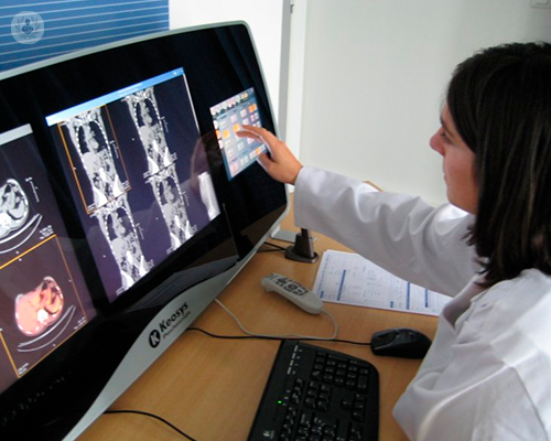i-vantaggi-della-tac-per-la-diagnosi-di-patologie immagine dell'articolo