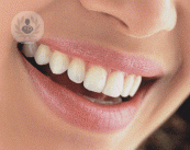 i-problemi-di-sviluppo-nella-dentatura-infantile immagine dell'articolo