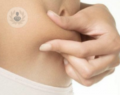 la-chirurgia-rimodellante-per-risolvere-i-problemi-di-flaccidita-corporea immagine dell'articolo