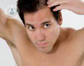 calvizie-maschile-perche-si-perdono-i-capelli immagine dell'articolo