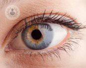 Il glaucoma: quali sono le cause?
