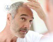 mi-rifaccio-la-testa-il-trapianto-di-capelli immagine dell'articolo