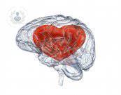 fibrillazione-atriale-attenzione-all-ictus immagine dell'articolo