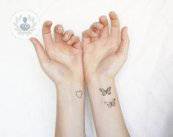 q-switched-rimuovere-i-tatuaggi-con-il-laser immagine dell'articolo