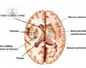 parkinson-conoscere-la-malattia immagine dell'articolo