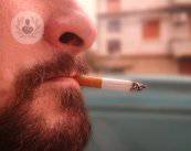 tumore-del-cavo-orale-tra-le-vittime-anche-i-giovani immagine dell'articolo