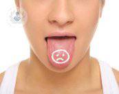 cancro-del-cavo-orale-riconoscerlo-e-affrontarlo immagine dell'articolo