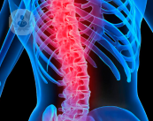 Chirurgia vertebrale: la stabilizzazione percutanea