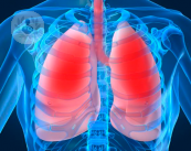 bpco-le-cause-i-sintomi-e-la-terapia immagine dell'articolo