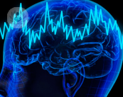 meningioma-cos-e-e-come-si-riconosce immagine dell'articolo