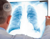asma-bronchiale-allergie-sintomi-e-terapie immagine dell'articolo