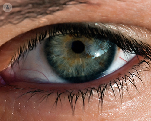 Malattie dell’occhio: il distacco del vitreo