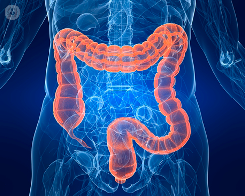 proctologia-la-videoproctoscopia-digitale immagine dell'articolo