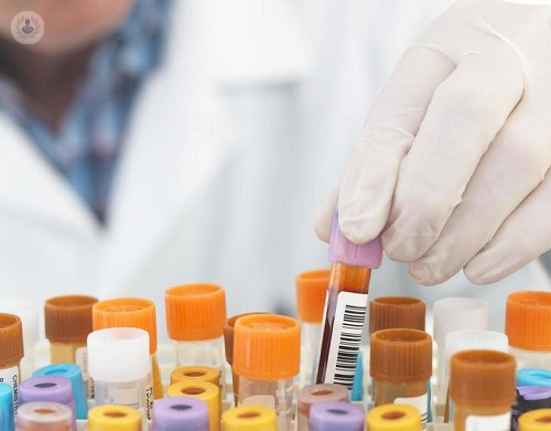 immunoterapia-oncologica-i-progressi-nel-trattamento-dei-tumori immagine dell'articolo