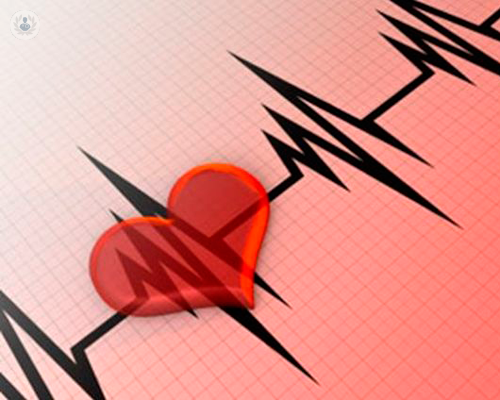 stenosi-carotidea-ed-endoarteriectomia immagine dell'articolo
