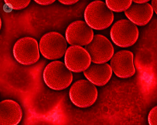 prp-e-possibile-curare-le-ulcere immagine dell'articolo