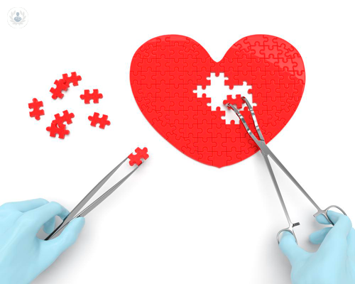 la-cardiochirurgia-mininvasiva immagine dell'articolo