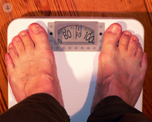 Obesità e sovrappeso: è questione di corrette abitudini