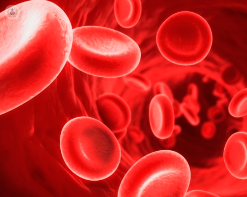 aneurisma-dell-aorta-addominale immagine dell'articolo