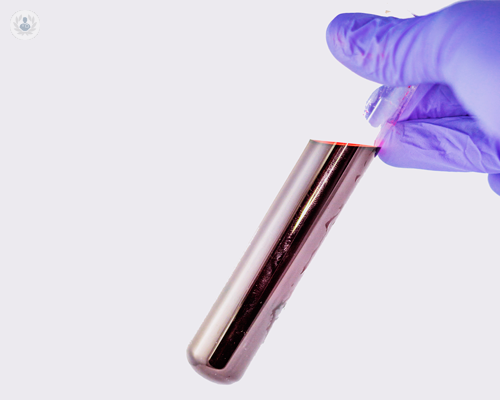 tumore-al-fegato-combatterlo-con-la-diagnosi-precoce immagine dell'articolo
