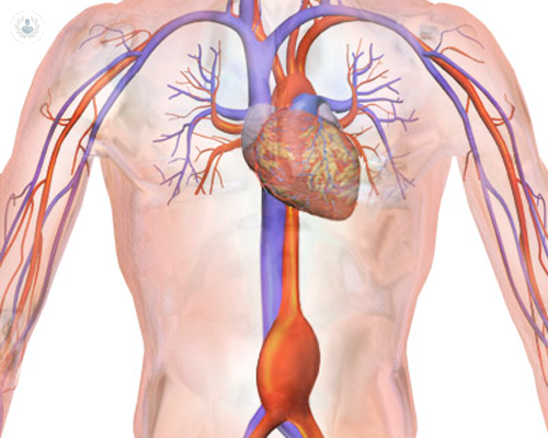 Diagnosi e Trattamento dell’Aneurisma dell’Aorta Addominale