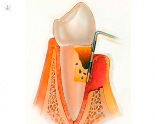 osteointegrazione-orizzonti-nuovi-e-piu-sicuri immagine dell'articolo