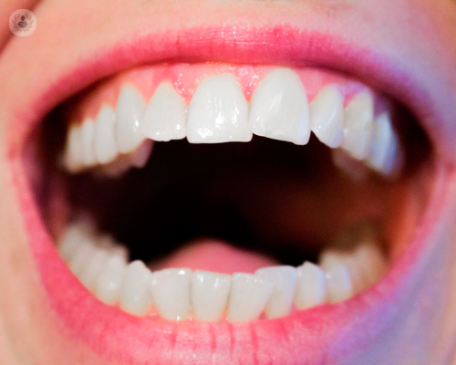 denti-del-giudizio-e-cisti-ci-pensa-il-chirurgo-maxillo-facciale immagine dell'articolo