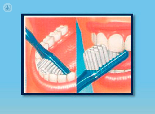 Igiene orale: i consigli per un sorriso perfetto