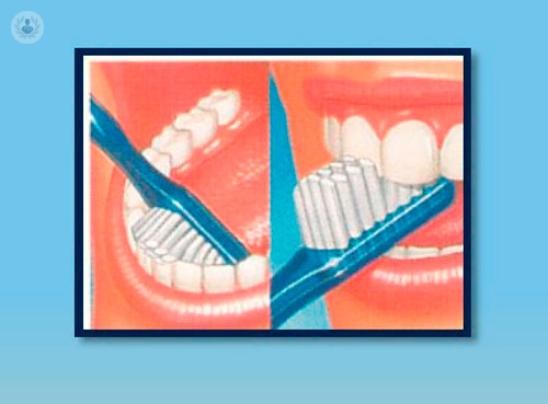igiene-orale-i-consigli-per-un-sorriso-perfetto immagine dell'articolo
