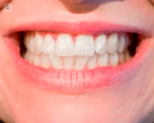 l-odontoiatria-per-i-pazienti-a-rischio-e-o-non-collaboranti immagine dell'articolo