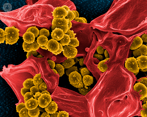 la-leucemia-linfatica-cronica immagine dell'articolo