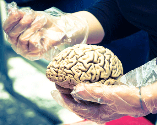 awake-surgery-operare-al-cervello-pazienti-coscienti-e-ora-possibile immagine dell'articolo