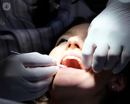 Implantologia dentale: i consigli dell’esperto