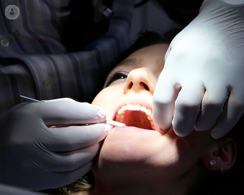 implantologia-dentale-i-consigli-dell-esperto immagine dell'articolo