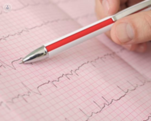 scompenso-cardiaco-e-fibrillazione-atriale-cause-diagnosi-e-cure immagine dell'articolo