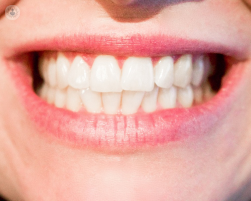 Denti e dentista: le risposte alle domande più frequenti