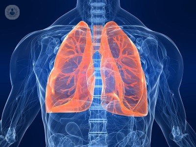 Metastasi polmonari: cosa sono e perché si formano!