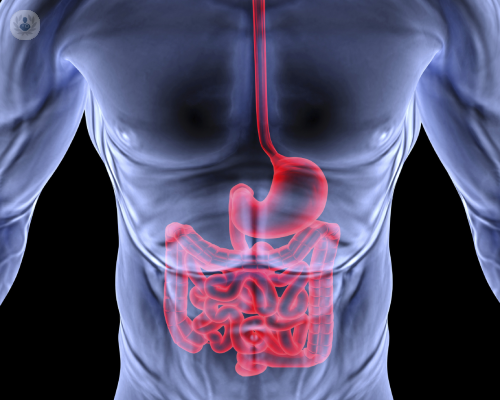 Colite ulcerosa e il morbo di Crohn: ecco le differenze!