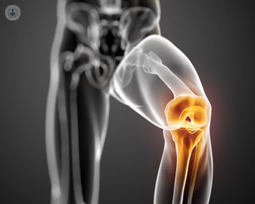 Dolore al ginocchio: quando è necessario consultare uno specialista!