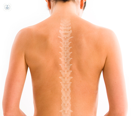 perche-trattare-l-ernia-del-disco-con-l-ozonoterapia immagine dell'articolo